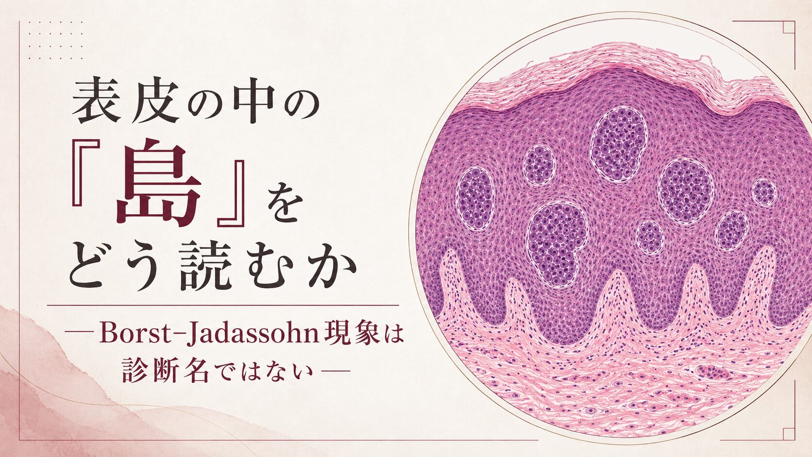 表皮の中の「島」をどう読むか―Borst–Jadassohn現象は診断名ではない―